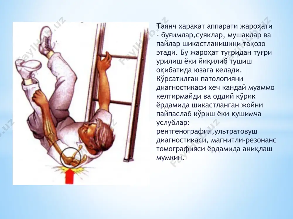 аппарати жароҳатлари орасида лат ейишлар, буғимларнинг шикастланишлари, мускулларнинг узилиши, чиқишлар(бир ёки бир қанча суякларнинг бўғимлардаги номал ҳолатидан чиқиб кетиши), очиқ ва ёпиқ синишлар фарқланади. биринчи ёрдам кўрсатиш жараенида бу ҳолатлардаги дифференциал диагностикани амалга ошириш қийин, шунинг учун қул ва оёқ жароҳатланишларининг аксарият холатларида энг оғир жароҳатлар сингари - синишлар каби эътибор бериб қараш лозим. оёқ-қуллар соҳасида жарохатлар кўриниши: оғриқ ва шиш пайдо бўлиши, буғимлардаги ноодатий харакат, деформация (суякларнинг калта булиб қолиши, суякларнинг узун бўлиб қолиши, ноодатий бурилиш) , харакатларнинг чекланиши, оёқ ва қуллар билан актив ва пассив харакатларни бажара олмаслик, жароҳат жойида шишиш ва қон қуйилиши; агар очиқ синишлар бўлса жароҳат жойида суякларнинг парчалари кўриниб туриши мумкин. очиқ жароҳатлар қон қуйилиш жараёнида кўп қон йўқотиши мумкин, шу билан бирга давом этган инфекцияланган синиқ оғир жойли йирингли процессга ва умумий йирингли зарарланишга олиб келади, бу бемор ҳаётига хавф туғдиради. биринчи ёрдам: жароҳатланган беморни транспорт воситалари орқали кўчирилиши лозим бўлса, синган оёқ …