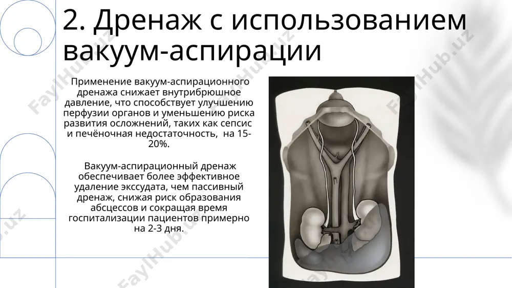 metodi drenirovaniya bryushnoy polosti pri peritonitax - Page 4