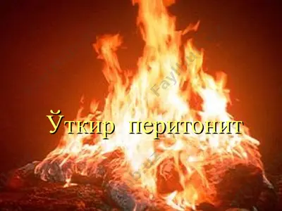 o'tkir peritonit — PPT