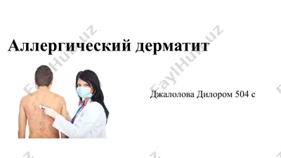 аллергический дерматит — PPTX