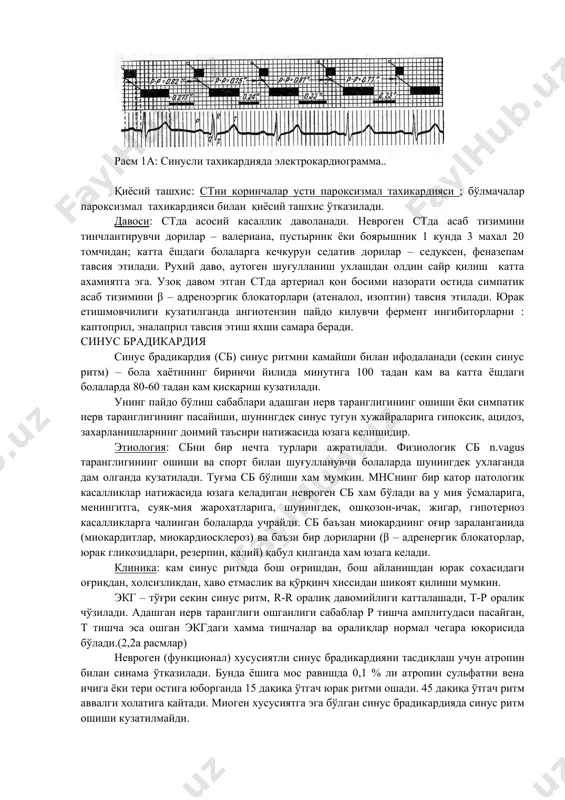 нинг балоғат ёшида ёки балоғат даврида намоён бўлади. патологик ст-юракни органик касалликлари фонида ривожланади: юракни туғма ва ортирилган нуқсонлари, миокардитлар, кардиомиопатиялар, юрак томир етишмовчилиги. синус тахикардия турли экстрокардиал касалликларда хам пайдо бўлади: сурункали туберкулёзли захарланишда, камқонликда, тиреотоксикозда, ўпканинг сурункали носпецифик касалликлари натижасида ривожланган гипоксияда. дорили ст узоқ муддат симпатомиметикларни атропин дориларини, глюкокортикостероидларни қабул қилганда намоён бўлади. узоқ бор бўлган ст турли генезлар натижасидаги қисқа диастола юрак мушакларини кислородга бўлган эхтиёжини оширади ва у қувватни кўп сарфланишига олиб келиб юрак мушакларида дистрофик ўзгаришлар пайдо этади. клиника: кўпинча болалар тахикардияни сезмайдилар бироқ юрак сохасидаги нохуш санчиқдан шикоят этадилар. объектив кўрикда тўғри ошган ритм кузатилади. юрак чўққисида i тон кучайган. агар тахикардия захарланиш ёки юракни оғир касалликлари натижасида бўлса бу холда у сусайган бўлади. экгда (нормадан) тез ошган синус ритм кузатилади. синусли келиб чиқувчи р тишча i ва ii стандарт ва аvl йўналишларда мусбат, avr йўналишда манфий. r-r оралик давомийлиги бўйича меъёрий, қисқа …