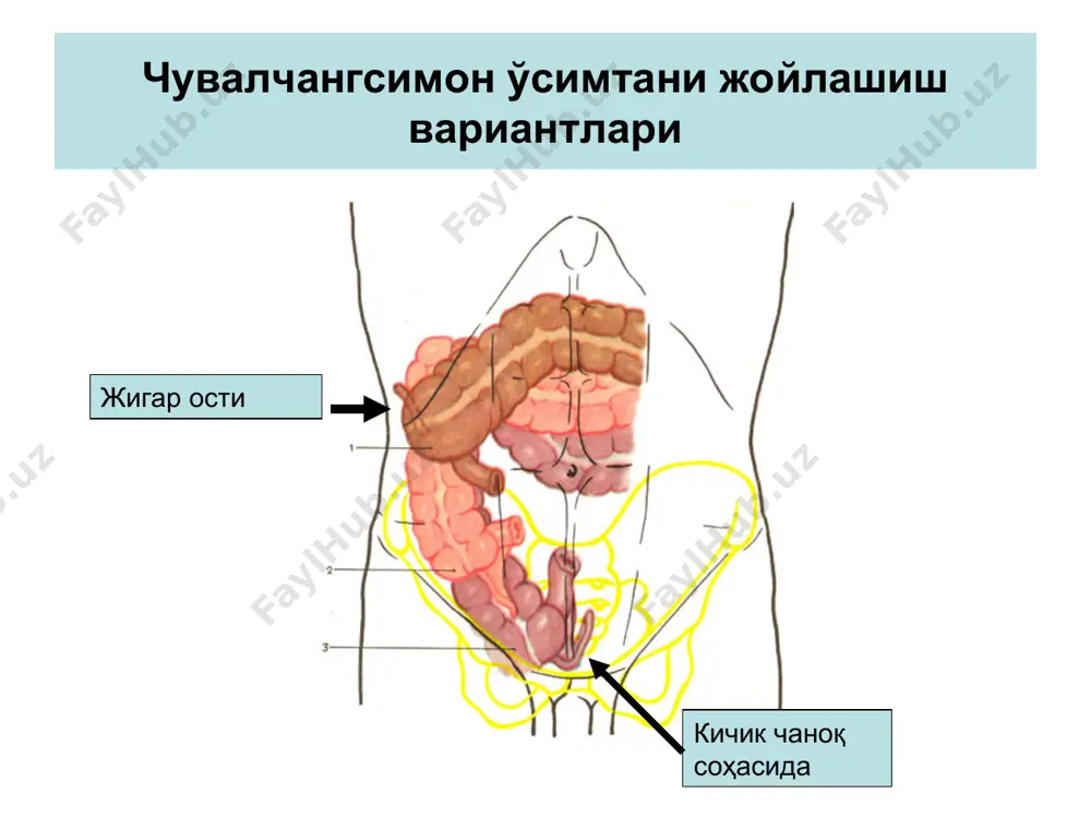 ўткир аппендицит - чувалчангсимон ўсимтанинг ўткир носпецефик яллиғланиши - Page 4