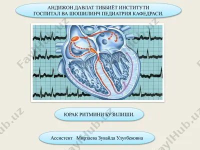 yu'rak ritmini buzilishi (aritmiya) — PPTX