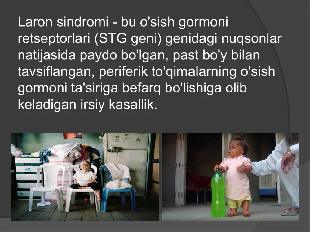 gan odamlarda qandli diabet yo'q, ammo buning sababi hali to'liq aniqlanmagan. erkaklarning o'rtacha balandligi taxminan 130 sm, ayollar - 120 sm. diagnostika odatda o'sish sur'atlarining sezilarli darajada sekinlashishi va stg-bog'laydigan oqsil, ifr-1 va ifr-bog'laydigan oqsil 3 turlarining pasayishi kuzatiladi. davolash o'sish gormoni dorilarini davolash odatda samarasiz. ifr-1 davolash uchun ishlatilishi mumkin rahmat image1.jpeg image2.jpeg image3.jpeg image4.jpeg image5.png image6.png image7.jpeg image8.jpeg image9.jpeg