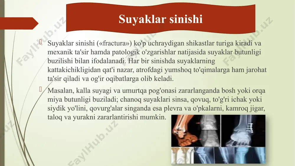 shishish; pastki oyoqning qisqarishi; gematoma; tos suyaklarining deformatsiyasi; cheklangan oyoq harakatlari; davolash tos suyagi sinishini davolash bir necha bosqichdan iborat. tibbiy protseduralar miqdori shikastlanishning og'irligiga bog'liq. avvalo shokka qarshi terapiya amalga oshiriladi. vaziyat etarli darajada behushlik bilan barqarorlashadi. shu maqsadda intrapelvik behushlik texnikasi qo'llaniladi. davolashning ikkinchi bosqichida infuzion terapiya o'tkaziladi. uning yordami bilan qon hajmining yo'qolishi to'ldiriladi. davolash qon bosimi, yurak urishi, qon va siydik sinovlarini normallashtirish uchun baholanadi. uchinchi bosqich - tos suyagi nuqsonlarini immobilizatsiya qilish. yengil jarohatlar bo'lsa, jabrlanuvchiga bir haftadan keyin yurishga ruxsat beriladi. terapiyaning keyingi taktikalari reabilitatsiya shifokori qaroriga bog'liq. klinik belgilari mahalliy va umumiy bo'ladi. umumiy belgilaridan ko'pincha travmatik shok, zararlangan to'qimalarning yemirilishi natijasida organizmda zaharlanish belgilari ro'yobga kelishi mumkin. 1. og'riq - shikastlanish paytida yuz berib, uning kuchi va davom etishi suyak parchalarining dislokatsiyasiga, suyak usti pardasi, nervi va boshqa yumshoq to'qimalarning zaharlanishiga, gematomaning hajmiga bog'liqdir. 2. deformatsiya - singan joy shaklining o'zgarishi, suyak …