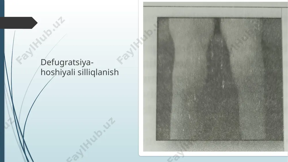 bemorlarga suyak bo’g’im tizimi - Page 5