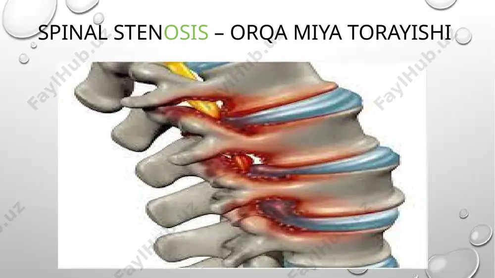 suffiksatsiya. klinik atamalar yasashda qo'llaniladigan atama elementlar - Page 5