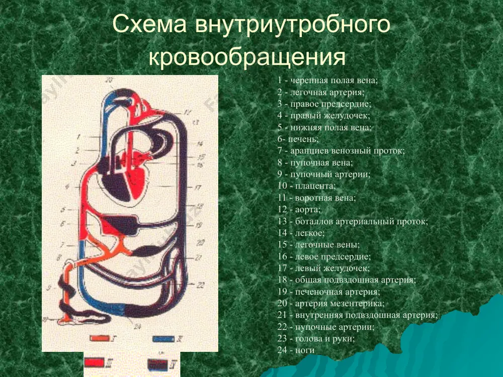х и органических шумов врожденные пороки сердца классификация врожденных пороков сердца впс: с обогащением малого круга кровообращения открытый артериальный проток гемодинамика при оап 1. сброс крови из аорты в легочную артерию 2. переполнение малого круга кровообращения (гипертензия) 3. границы сердца расширены влево и вверх - частые простуды, лор патология -одышка -утомляемость -бледность -отставание в физ. развитии дефект межпредсердной перегородки (дмпп): нарушение гемодинамики 1. сброс артериальной крови слева направо 2. увеличение минутного объема малого круга кровообращения 3. границы сердца расширены в поперечнике и вправо 4. грубый систолический шум во втором, третьем межреберье слева от грудины рентген: тени легочных рисунков расширены. поперечные тени сердца увеличены за счет правых отделов и легочной артерии дефект межжелудочковой перегородки: гемодинамика: 1. сброс крови из левого желудочка в правый 2. переполнение малого круга кровообращения 3. перегрузка обоих желудочков 4. при аускультации слева от грудины в третьем-четвертом межреберье определяется систолическое дрожание, проводящееся над всей сердечной областью и на …
