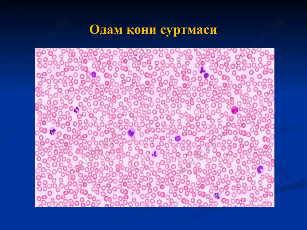 қон ва лимфа. гемопоэз - Page 4
