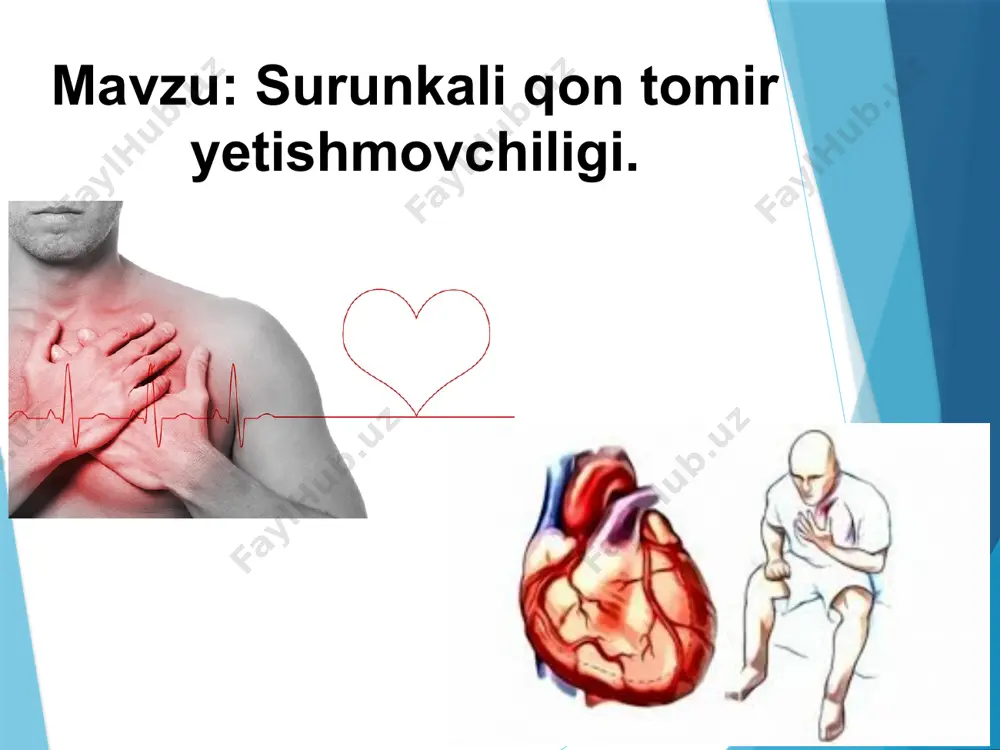 v olib o‘tishga sarflanadi. v) miokard xujayralarida energiyani sarflanishini buzilishi miozinning atfazasi, sarkolemmani k+-na+ga bog‘lik atfazasini , spt dagi sa2+ kompasini mg2+ga bog‘lik atfazalarini aktivligini pasayshi xisobiga bo‘ladi. yuiyening patogenetik faktorlari 2 2. kardiomiotsitlar membranalarini va ferment sistemalarini shikastlanishi: xujayra gidrolitik fermentlarini xaddan tashqari aktivlashishi, lipidlarni gidroliz maxsulotlari membranalarga detergent ta’siri. membranalarda yog‘ va oksil molekulalarini resintezi tormozlanadi. oksil va lipoproteid molekulalarini konfor-matsiyasi buziladi. xujayra osmotik va onkotik bosimni oshishi esa sarkolemma va organelalarni membranalarida mikro yoriqlar xosil qiladi. yuiyening patogenetik faktorlari 3 3. kardiomiotsitlarda ion va suyuqliklarni disbalansi. yuiyeda na+ni xujayra ichida ko‘payishi mioplazmada sa2+ ushlab koldiradi. sprda sa2+ nasosini aktivligini pasayishi va boshqalar. yuiyening patogenetik faktorlari 4 sa2+ xujayra ichida ko‘paysa: - miofibrillar bo‘shashi buziladi, diastolik bosim ortadi. - mitoxondriyalar sa2+ni tutib qoladi va o/f ajraladi. bu vaqtda glikoliz kuchayib n+ yig‘iladi. n+lari spr va sarkolemmadan sa2+larini siqib chiqaradi xamda sa2+ni troponinga bog‘lanuvchi joylariga konkurentlik qi­ladi. - sa2+ga …