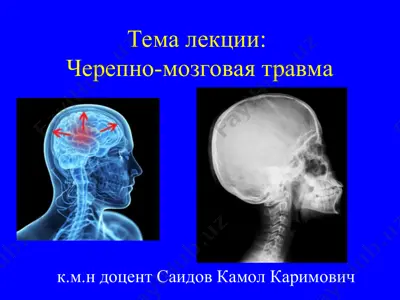 cherepno-mozgovaya travma — PPT