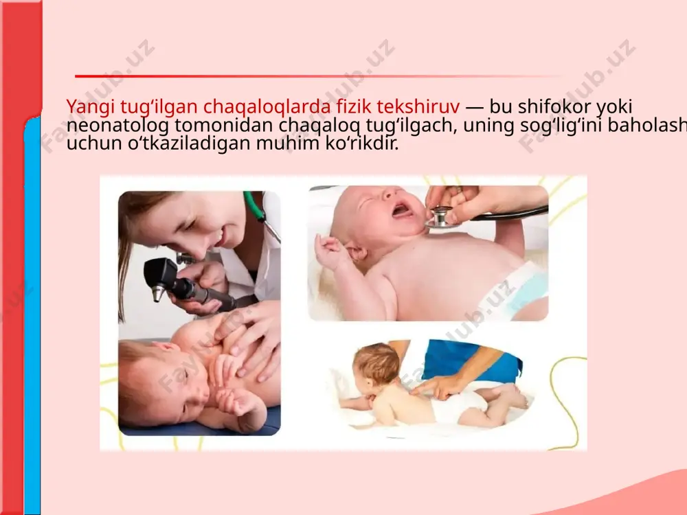 va orqa chiqaruv teshigi orqa chiqaruv yo‘li ochiqligi tekshiriladi. jinsiy a’zolar: rivojlanishi va joylashuvi tekshiriladi. 7. mushak va suyak tizimi qo‘l-oyoq harakati: faol, reflekslar mavjud. orqa va umurtqa: to‘g‘ri va deformatsiyasiz. 8. neonatal reflekslar (asosiy tug‘ma reflekslar) moro refleksi. bu refleks turli yo‘llar bilan hosil qilinadi: shifokor qo’lida bolani tutib turib, uni birdaniga 20 sm pastga tushirib, keyin yana ko‘targanda va bola yotqizilgan stol ustini urganda (bolaning boshidan 15-20 sm uzoqroqda) bu reaksiyalarga bola quyidagicha javob beradi. 1. qo‘llarini ikki chetga qiladi yoki barmoqlarini yozadi. 2. yana boshlang'ich holatga qaytaradi. bunda ushlashga xos harakat yuzaga keladi. bu 4 oygacha saqlanib, keyin yo‘qoladi. qidirish refleksi. bu refleksda og’iz yoki labga tegishga javoban yangi tug’ilgan chaqaloq boshini tegib turgan tomonga buradi. ushbu refleks yangi tug’ilgan chaqaloqlarga so’rg’ichni topishga imkon beradi. so’rish refleksi. yangi tug’ilgan chaqaloqning og’ziga biron bir narsa qo’yilganda ( masalan,so’rg’ich ), u darhol so’rish harakatlarini qila boshlaydi. 1.yangi tug‘ilgan chaqaloqlarda …