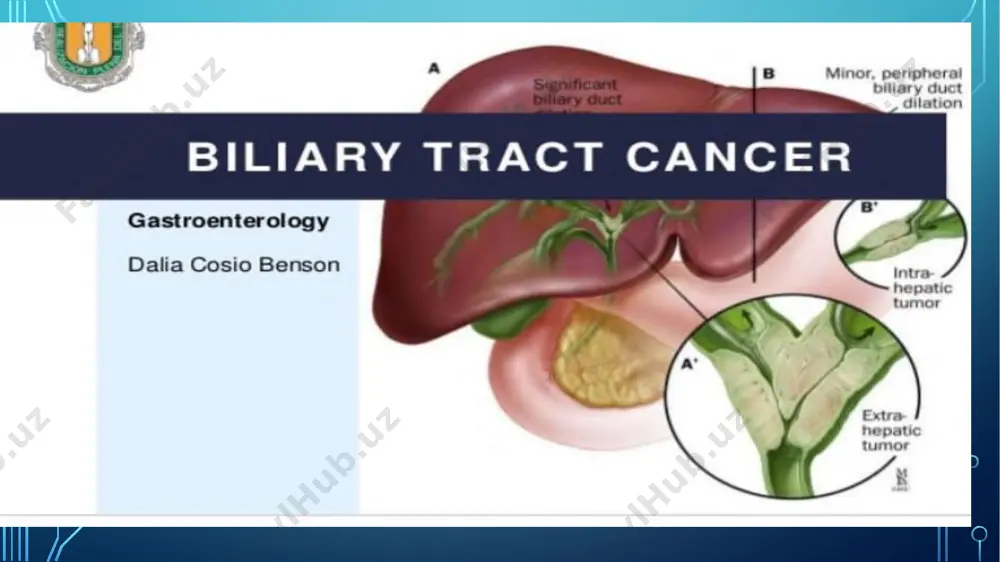 nts with right upper quadrant abdominal pain. ct scan usually demonstrates a mass replacing the gallbladder or extending into adjacent organs cholangiography also may helpful in diagnosing jaundiced patients with gallbladder cancer . s bile duct cancer incidence ; male to female ration of 3:1 average age of presentation is 50-70 etiology common feature of risk factors include biliary stasis,bile duct stones and infection choledocal cysts,hepatolithiasiss. other risk factors include liver flukes , nitrosomines,dioxin exposure. thank you for your attention doctor :axmadovna s. image2.png image3.jpg image4.jpg image5.png image6.jpg image7.png image8.png image9.jpg image10.png image11.png image12.png /docprops/thumbnail.jpeg