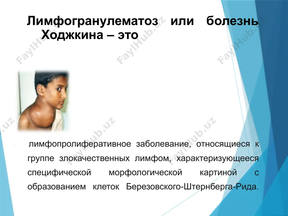 качественных заболеваний лимфатической системы.пол. мужчины чаще болеют бх, чем женщины. перенесенная инфекция эпштейн-барра. лица, перенесшие инфекционные заболевания, вызванные вирусом эпштейн-барра, например, инфекционный мононуклеоз, значительно чаще болеют ходжкинской лимфомой. ослабленная иммунная система. нарушения работы иммунной системы, например носительство вич или заболевание спидом, состояние после пересадки органов (предусматривает прием препаратов, угнетающих работу иммунной системы) повышает вероятность возникновения бх. морфологические варианты лгм лимфогистиоцитарный; лимфоцитарное преобладание. характеризуется выраженной пролиферацией, эозинофильные гранулоциты и плазматические клетки встречаются редко, клетки березовского-штернберга встречаются непостоянно, очаги некроза и фиброза отсутствуют. нодулярный склероз. характеризуется развитием своеобразных грубоволокнистых кольцевидных прослоек соединительной ткани, разъединяющих всю ткань лимфоузла на отдельные узелки. типичны клетки березовского-штернберга, встречаются очаги некроза, нейтрофилы и гистиоциты. нодулярный склероз смешанно-клеточный. характеризуется пестрой картиной клеточного состава, с большим количеством клеток березовского-штернберга. нередко в процесс вовлечена вся ткань лимфатического узла. иногда обнаруживается незначительное количество ретикулярных и коллагеновых волокон. лимфоидное истощение. отличается выраженным беспорядочным развитием соединительной ткани и значительным уменьшением клеточного состава ткани …