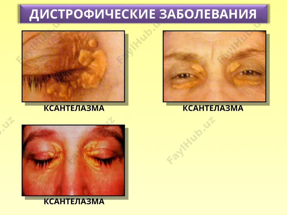 zabolevaniya pridatkov glaza, rogovichy i sklery - Page 5
