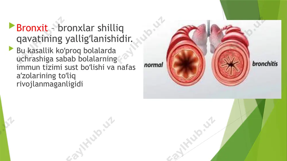 ish faoliyatini tekshirish o`pkalar rentgengrafiyasi (skopiyasi) bronxoskopiya (ko`rsatma asosida) davolash virusga qarshi preparatlar antibakterial davo antibakterial davo balg`am ko'chiruvchi dorilar yo'talga qarshi dorilaryallig`lanishga qarshi va isitma tushiruvchi preparatlari bronxlarni kengaytiruvchi dori preparatlari prednizolon prednizolon desensibilizasiyalovchi surunkali bronxit bronxlarning surunkali diffuz noallergik yallig`lanishi bilan xarakterlanib, balg`amli yo`tal va bronxlarning surunkali diffuz noallergik yallig`lanishi bilan xarakterlanib, balg`amli yo`tal va qansirash bilan namoyon bo'ladigan kasallik bjsst bo'yicha – 2 yil davomida yiliga 3 oydan kam bo'lmagan vaqt davomida balg`amli yo`tal bo`lgan bjsst bo'yicha bo`lgan bemorlar surunkali bronxitli bemorlar jumlasiga kiritiladi tarqalganligi: nafas tizimi barcha kasalliklarining 80% nafas tizimi kasalliklari bo`yicha nogironlikning 50% ini t ashkil etadi asoratlari infeksiya bilan bog`liq (pnevmoniya, bek, ba (noaller) va astmatik) infeksiya bilan bog`liq evolyusiyasi bilan bogliq (o`e, diffuz pnevmoskleroz, o`pka- yurak, o`ng qorincha yetishmovchiligi bilan bogliq tekshirish dasturi umumiy klinik tekshiruvlar balg`am taxlili balg`am taxlili tnf tnf ko`krak qafasi rentgenografiyasi ko`krak qafasi rentgenografiyasi bronxografiya kt davolash-bronxlar o`tkazuvchanligini …