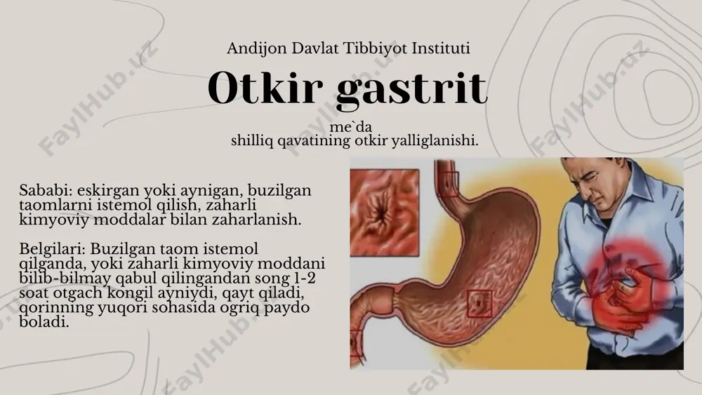 instituti andijon davlat tibbiyot instituti endogen sabablarga: surunkali yallig’lanish (og’iz bo’shlig’i, halqum va nafas olish organlarining yallig’lanish kasalliklari, o’pka sili, surunkali xoletsistit, enterokolit va h.k.); endokrin bezlari kasalliklari (addison kasalligi, gipoterioz, buqoq, itsenko— kushing kasalligi, qandli diabet); kasallangan a’zolardan reflektor ta’sir o’tishi (xoletsistit, gepatit va b.); modda almashinuvining buzilishi (o’ta semizlik, organizmda temir moddasining yetishmovchiligi, padagra); to’qimani gipoksiyaga olib keluvchi kasalliklar (yurak-tomirlar yetishmovchiligi, jigar va buyrak yetishmovchiligi); allergiya natijasidagi surunkali gastrit kiradi surunkali gastritning kelib chiqishida ekzogen sabablarga 1982- yilda avstraliyalik olimlar varren va matchkllar spiralga o’xshagan bakteriyaning rolini ta’kidlaganlar. uning nomi kampil pilori bakteriyasi deb atalgan. keyinchalik (nr) deb yuritildi. eʼtiboringiz uchun tashakkur andijon davlat tibbiyot instituti image1.png image2.svg image2.png image4.svg image3.png image6.svg image4.jpeg image5.jpeg image6.jpeg image7.jpeg image8.jpeg image9.jpeg image10.jpeg /docprops/thumbnail.jpeg