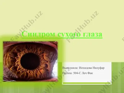 sindromsuxogoglaza — PPTX