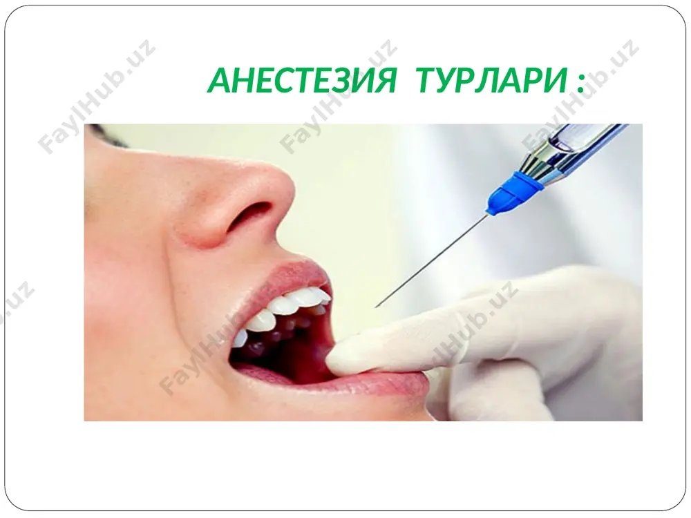 5-10 % ли малхамлар; 0,1 – ректал шамчалар. тримекаин тримекаин курсатма: инфильтрацион ва утказувчи анестезияда, талвасада, нерв системасининг юкори кузга-лувчанлигида, аритмияда; ножуя таъсирлари: ачишиш, кунгил айниш, кусиш, клоник талваса; лидокаин гидрохлорид лидокаин гидрохлорид курсатма: юза, инфильтрацион, регионар, перидурал, субарахноидал анестезияда, бошка анестетикларни кутара олмасликда, аритмияда; карши курсатма: брадикардияда, сурункали юрак етишмовчиликларида, кардиоген шок, артериал гипотония, жигар етишмовчилигида; ножуя таъсирлари: уйкучанлик, куришнинг бузилиши, кунгил айниш, тремор, талваса, юрак-кон томир етишмовчилиги, нафас бузилиши. лидокаиннинг дозаси ва чикарилиш шакли: дозаси: 0,25-0,5% ли эритма инфильтрацион анестезия учун; 0,5-2% ли эритма – утказувчан анестезия учун; 1-5% эритма – терминал анестезия учун; 0,25 - ичишга чикарилиш шакли: 1% ли 10-20 мл ли ампулаларда; 2% ли эритма 2-10 мл ли ампулаларда; 10% ли эритма 2 мл ли ампулаларда; 0,25 – драже. бупивикаин гидрохлорид (маркаин, карбостезин) бупивикаин гидрохлорид (маркаин, карбостезин) курсатма: утказувчи, инфильтрацион, эпидурал анестезия; дозаси: хирургик стоматологияда 0,25; 0,5; 0,75% ли эритмалари кулланилади. артикаин артикаин курсатма: стоматологияда …