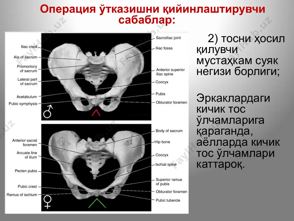 найидан . параректал тугунларга – тўғри ичак ампуласидан. сакрал тугунларга – тўғри ичак, бачадон, қиндан. тос бўшлиғи лимфа тизими юқоридан тос диафрагмасининг пастки юзаси; пастдан – юза фасция ва оралиқ териси билан чегараланган. тери ости бўшлиғи (саvum реlvis subcutaneus) тос диафрагмасини m.levator ani ҳосил қилиб, тос аъзоларини пастдан ушлаб туради. олдинда, унинг қирғоқлари орасида сийдик-таносил диафрагмаси жойлашиб, у орқали сийдик чиқарув канали (ва қин) ўтади. тоснинг тери ости бўлимида, тўғри ичак анал қисмининг ён томонларида қуймич-тўғри ичак чуқурлиги (fossa ischiorectale) жойлашган. бу ерда тўғри ичак жароҳатлари, оқмалари, ректал (геморроидал) веналар бўйлаб инфекция тарқалиши натижасида парапроктитлар ривожланиши мумкин. парапроктитлар: пелвиоректал, шиллиқ ости, ишиоректал, тери ости, тўғри ичак орти. тери ости бўшлиғи (саvum реlvis subcutaneus) парапроктитларни очиш ва дренажлаш перинеал абсцессни очиш. тўғри ичак орти абсцессини очиш. ишиоректал абсцессни очиш текшириш усуллари жуда ҳам кенг имкониятлар бор, шулардан: пальпация - per rectum ёки қин орқали; қинни кўздан кечириш (қин ойналари ёрдамида); цистоскопия; …