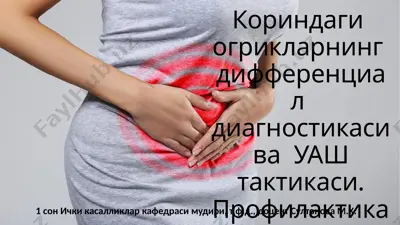 лапароскопик холецистэктомия — PPTX