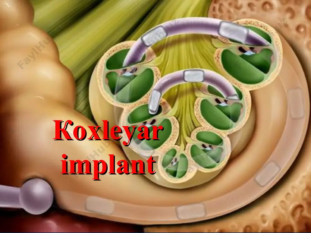 r implantining monoblokli modeli koxlear implantatsiya afferent eshitish nerv tolalarini to'g'ridan-to'g'ri elektr stimulyatsiyasi orqali eshitish sezgisini tiklash uchun elektrod tizimlarini ichki quloqqa implantatsiya qilishni anglatadi. koxlear implantatsiya odatda eshitish chegaralariga nisbatan 30-40 db gacha bo'lgan eshitish chegaralarini ta'minlaydi, ya'ni butun chastota diapazonida deyarli normal nutqni idrok etish imkoniyatini beradi. koxlear implantasiya bosqichlari 30 dan ortiq mutaxassislar ishtirok etadi operatsiyadan oldingi diagnostik tekshiruv - 5 kun, 16 mutaxassis. 2. koxlear implantasiya operatsiyasi - - 1 kun (3-5 soat), 5 mutaxassis. 3.operasiyadan keyingi reabilitasiya - - 3-haftadan 2-yilgacha, 14 mutaxassis va ota-onalar. operatsiyadan oldingi diagnostik tekshiruv umumiy tibbiy tekshiruv; аudiologik tekshiruv; rengonologik tekshiruv; psixolonevrologik tekshiruv; psixologo-pedagogik tekshiruv. operasiyadan oldingi ishlarning vazifalari: оценить слуховую функцию, включая состояние улитки и слухового нерва; оценить соматическое состояние пациента; оценить особенности психического развития; оценить уровень слухового восприятия и уровень речевого развития; оценить перспективность использования ки для восприятия речи после операции; сформировать у пациента и его близких адекватные …