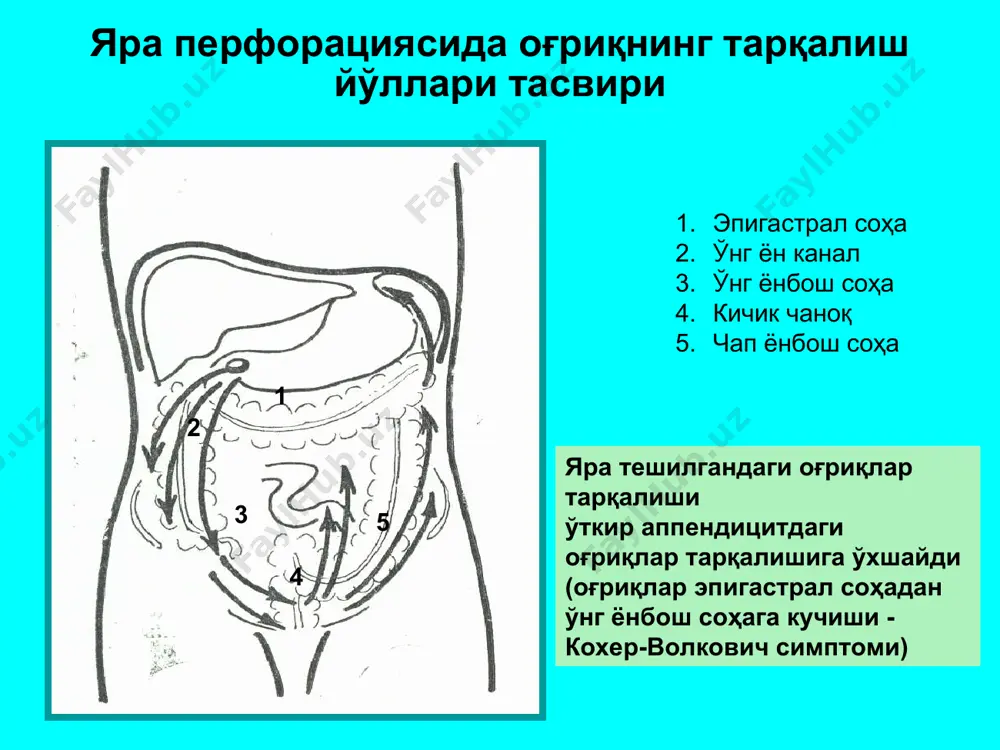 меъда ва 12бармоқли ичак яра касаллиги асоратлари - Page 5