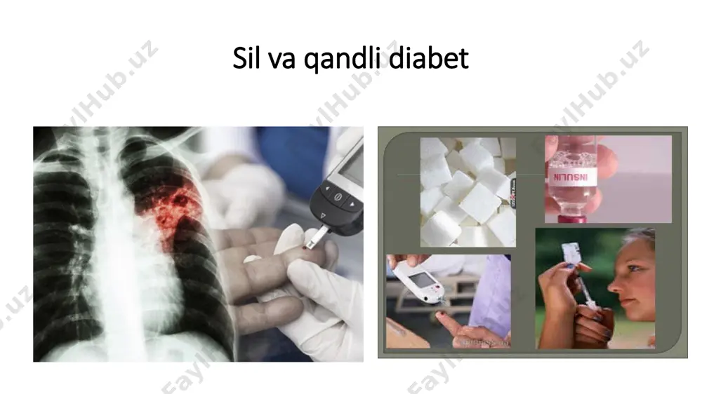 paratlarni ko'tara olishligi • akusherlik anamnez; • bemorni davolash va kuzatuvi. silda homiladorlikni to'xtatishga ko'rsatma  yangi aniqlangan sil jarayonini shiddatli kechishi, sil meningiti, miliar sil; fks, o'ds, tsirrotik sil (o'yuye bilan);  silni qandli diabet va boshva surunkali kasalliklarning funktsional buzilishlari bilan  jarroxlik muolajasi talab qilinadigan o'pka sili homiladorlikni to‘xtatish: ayolni yozma roziligi bilan; homiladorlikni erta davrlarida(12 xaftasigacha); homiladorlikni kechki muddatlarda to'xtatish sil jarayonini avj olishiga olib keladi; abortdan oldin va keyin silga qarshi davolashni kuchaytirish lozim qayta homiladorlik 2-3 yildan so'ng tavsiya qilinadi