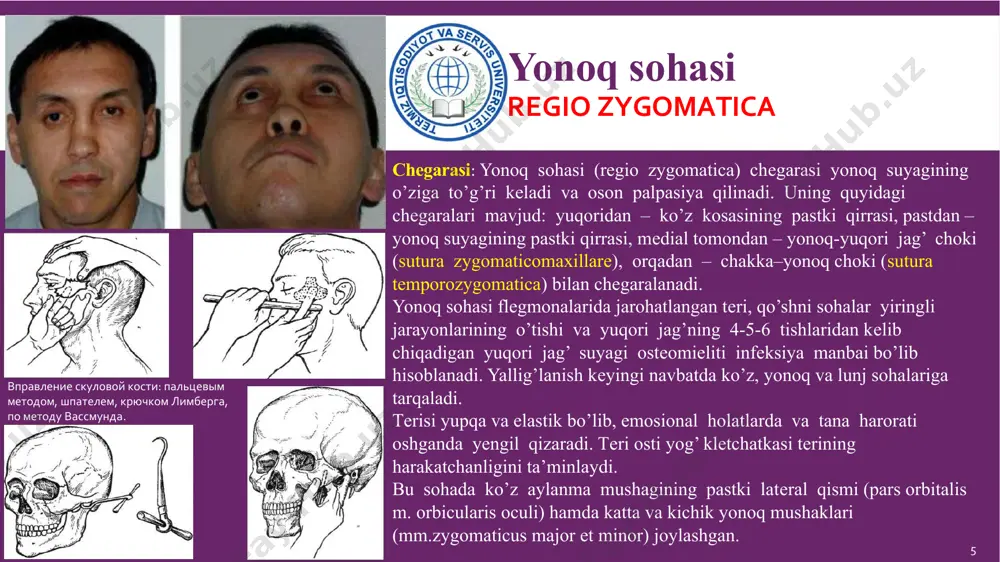 ib, o’zida pеshona va ko’z usti tеshiklarini (foramen frontale et supraorbitale) saqlaydi. bu tеshiklar orqali pеshona bo’shlig’iga ko’z usti va g’altak usti tomir-nеrv tutamlari (vasa supraorbitalis et supratrochlearis) chiqadi. ko’z kosasi ostki qirrasi (margo inpraorbitalis) ko’z sohasini ko’z osti va yonoq sohalaridan ajratib turadi. 14 ko‘z sohasi область глазницы ko’z kosasi 4 qirrali piramida shaklida bo’lib, uning chuqurligi 4-5 sm ni tashkil etadi. ko’z kosasida 4 ta dеvor tafovut etiladi. ko’z kosasi bo’shlig’i ko’z aponеvrozi yoki tеnon fassiyasi (bonne kapsulasi) yordamida 2 qismga bo’linadi: oldingi (pars bulbosa) va orqa (pars retrobulbosa). ko’z yosh apparati ko’z yosh bеzidan va yosh chiqaruvchi yo’llaridan tashkil topgan. yosh chiqaruvchi yo’llarga ko’z yosh ko’li, ko’z yosh nuqtasi, ko’z yosh kanali, yosh хaltasi hamda burun-ko’z yosh kanali kiradi. 15 yuzning old qismi kuz osti sohasi ko’z kosasi osti sohasi (regio infraorbitalis) qoziq tish chuqurchasi sohasiga to’g’ri kеladi. chеgaralari: yuqoridan ko’z kosasi ostki qirrasi, pastdan - yuqori …