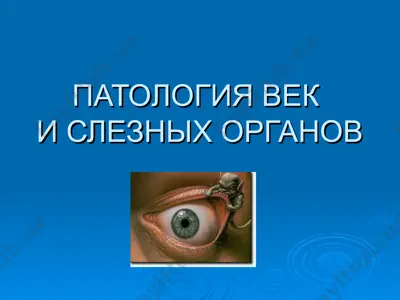патология век и слезных органов — PPT