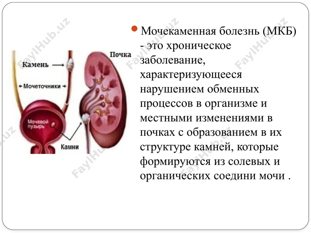 ложный раствор, перенасыщенный растворенными минеральными солями (кристаллоидами) и состоящий из мелкодисперсных белковых веществ (коллоидов). последние, находясь в химическом взаимоотношении с кристаллоидами, удерживают их в моче здорового человека в растворенном виде, т. е. создается коллоидно-кристаллоидное равновесие. при нарушении количественных и качественных соотношений между коллоидами и кристаллоидами в моче могут наступить патологическая кристаллизация и камнеобразование. одним из значимых факторов камнеобразования является реакция мочи (рн). она определяет оптимум активности протеолитических ферментов и седиментацию мочевых солей.) основные симптомы мочекаменной болезни: боль может носить острый (почечная колика) или тупой, ноющий характер. причиной почечной колики является внезапное нарушение оттока мочи от почки, в результате обструкции мочеточника камнем. боль носит внезапный характер, с периодами облегчения и повторными приступами. локализуется боль в области почки или по ходу мочеточника и имеет типичную иррадиацию вниз в подвздошную, паховую области. больные ведут себя беспокойно, не находя положения тела, при котором болевые ощущения бы уменьшились. тупой, ноющий характер болей характерен для воспалительного …