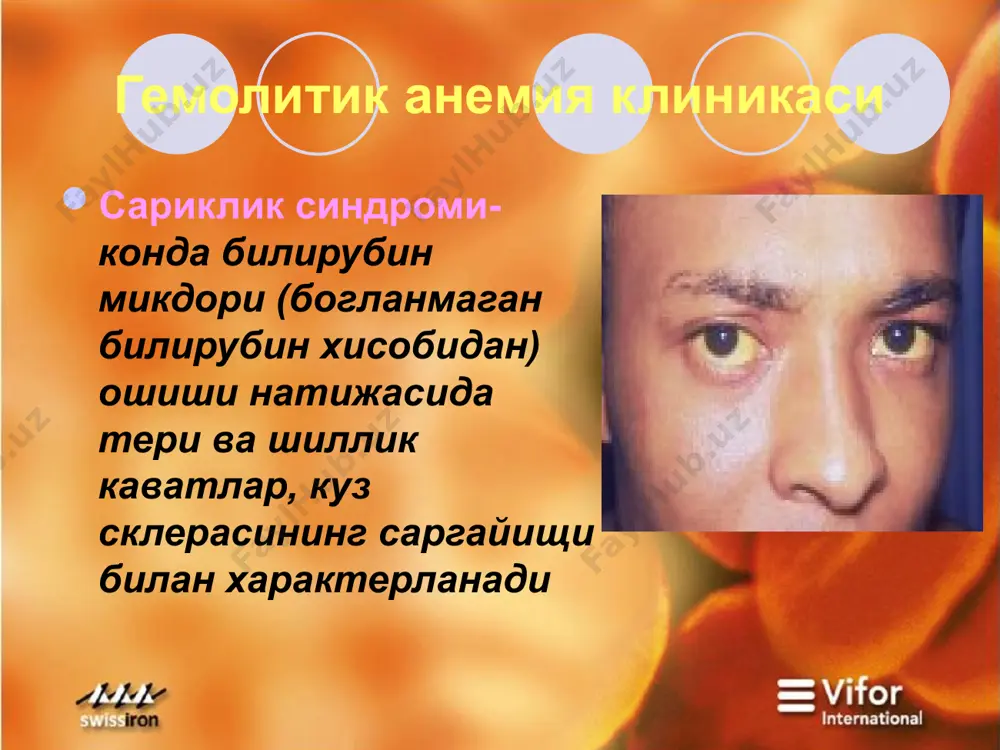 гемолитик анемия - Page 5