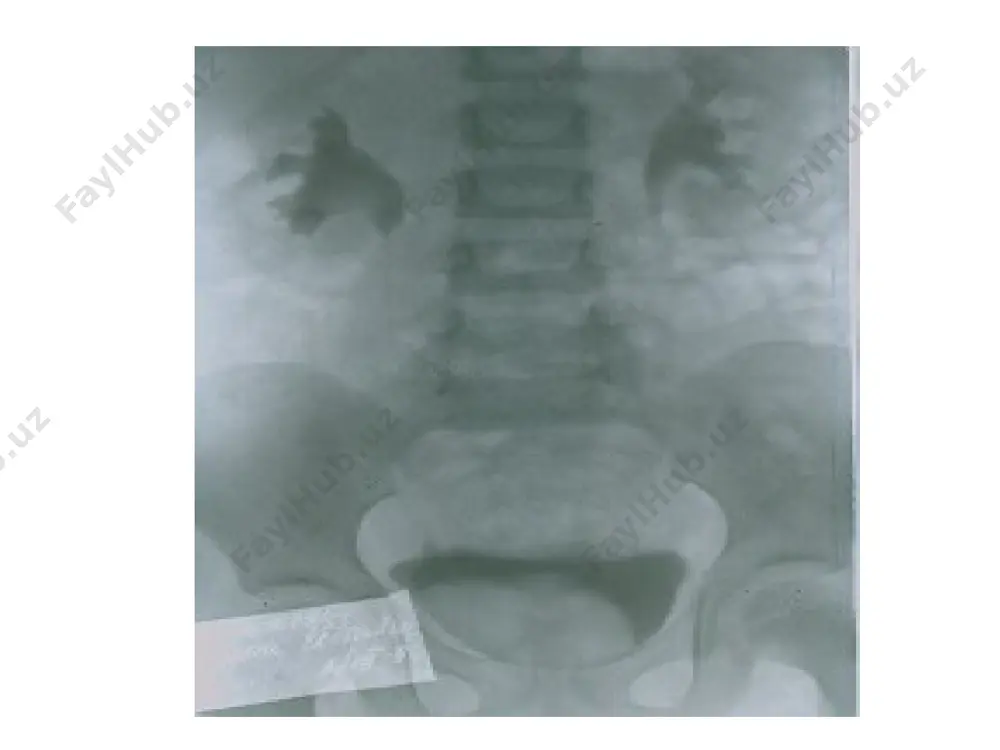 urologik diagnostika apparatlari - Page 4