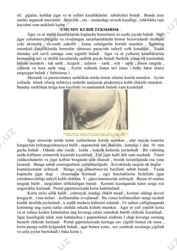 oletsistitda xam kuzatiladi. ut-tosh kasalligidagi va xoletsistitdagi ogriklar ut pufagi va ut yullari muskullarining spastik kiskarishidan kelib chikadi. surunkali xoletsistit va ut yullari diskineziyasida ung kovurgani ostida ogriklar kuchsizrok bulib, ogizdan achchik ta’m keladi, kungil aynishi, ishtaxaning pasayishi, ayrim xollarda kayt kilish kabi dispeptik xollar bilan kechadi. jigar kasalliklaridagi (gepatit) ogrik jigar kattalashishi tufayli nerv tolalariga boy glisson kapsulasini chuzilishi yoki perigepatit tufayli kelib chikadi. ayrim xollarda jigar va ut yullari kasalliklarida teri va shillik kavatda sariklik kuzatiladi. utkir infeksion gepatitda jigarni zamburug, fosfor va x.k.lar bilan zaxarlanishida jigar parenximasi zararlanishi tufayli sariklik kelib chikadi. bunga parenximatoz sariklik deyiladi. bunda siydik tuk rangga kiradi, axlat okaradi. umumiy ut yulida tosh paydo bulgan takdirda jigar darvozasi limfatik tugunlarida rak metastazlari paydo bulganda xam sariklik kelib chikadi. bunga mexanik sariklik deyiladi. bunda siydik tuk rangga kiradi, axlat okaradi. mexanik sariklikda bemorlar terining kichishidan shikoyat kiladilar. kichishish teridagi nerv oxirlarining ut kislotalari bilan …
