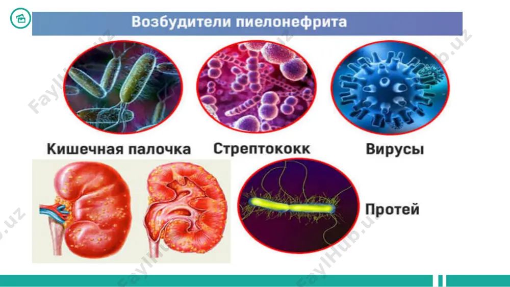 umiy prinsiplari : • antibiotiklarni buyurish siydikni bakteriologik ekishning natijalariga asoslangan bo'lishi kerak. • antibiotikogrammaning natijasini olgunga qadar keng spektorli antibiotiklar qo'llaniladi. • antibiotikoterapiyaning samaradorligi davolash boshlangandan 48-72 soat so'ng aniqlanadi. o'tkir asoratlanmagan pielonefritni davolash. • trimetoprim / sulfametoksazolni qo'llash ampitsillinga nisbatan afzalroqdir; • ftorxinolonlar – davolash kursi 7 -10 kun; • sefalosporinlar 2-3 generatsiyasi aminoglikozidlar bilan birgalikda, davolash kursi 7-10 kun. • alternativ preparatlar: aminopenitsillin / β – laktamaza ingibitorlari. antibiotikoterapiya saradorligini baxolash: • klinik: • umumiy axvolining yaxshilanishi; • tana xaroratining normallashuvi; • og'rikning yo'qolishi yoki kamayishi. • laborator: • bakteriuriyaning yo'qolishi va leykotsituriyaning bir necha marotaba kamayishi. e'tiboringiz uchun rahmat 26 image1.jpeg image2.jpeg image3.jpeg image4.jpeg