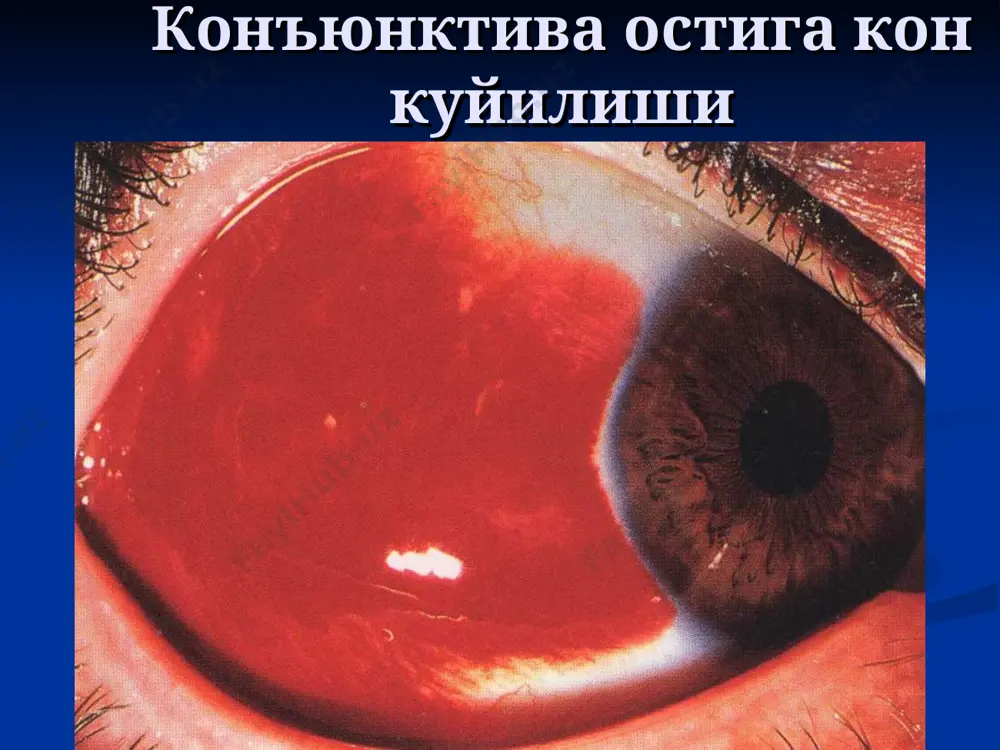 курув аъзоси травмалари - Page 4