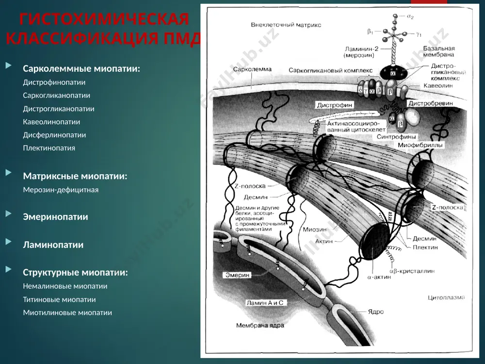 nevozmojno. varianti techeniya pmd 1) neblagopriyatniy variant — obezdvijennost cherez 5—10 let ot nachala bolezni, bistroe narastanie narusheniya jiznedeyatelnosti, invalidizatsii; 2) sredniy temp progressirovaniya — cherez 10—15 let imeyutsya virajennie dvigatelnie narusheniya, prognoz v otnoshenii vozmojnosti samoobslujivaniya ploxoy; 3) medlenniy temp progressirovaniya — cherez 10—15 let ot nachala bolezni net virajennix dvigatelnix narusheniy, bolnoy svobodno peredvigaetsya, trudovoy prognoz na blijayshie godi otnositelno blagopriyaten, vozmojna chastichnaya trudovaya adaptatsiya, inogda opravdano professionalnoe obuchenie. miodistrofiya dyushenna frantsuzskiy nevrolog julem bendjamin amand dyushenn vpervie opisal zabolevanie v 1861 g. guillaume benjamin amand duchenne miodistrofiya dyushenna naibolee rasprostranennaya forma pmd. zabolevaemost - 13–33 sluchaya na 100 000 rodivshixsya. tip nasledovaniya: ar, x- stseplenniy. geni kartirovani na korotkom pleche x-xromosomi, v 21-m lokuse (xr21). v osnove - narushenie sinteza distrofina: deletsii gena distrofina razlichnoy protyajennosti, 5-10% sluchaev – duplikatsiyami chasti gena, u ostalnix - tochkovie mutatsii. proksimalnie deletsii gena chashe viyavlyayutsya pri semeynix formax bolezni, distalnie …