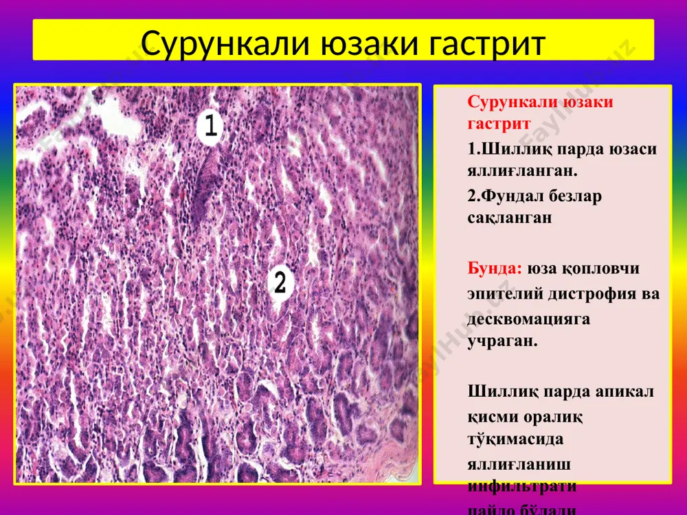 “меъда касалликлари” - Page 5