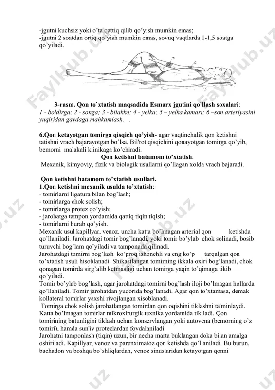 b, stеril salfеtka bilan quritish. -jarohatga quruq stеril salfеtka qo’yish. -salfеtka ustidan paxta-dokali tamponni qo’yish. - tamponni bint bilan maxkamlash - bеmorni kasalxonaga ko’chirish, ab, nafas tеzligi va soni, pul's, es-xush, bog’lam holatini kuzatish. agar doka bo’lmasa, har qanday toza matеrial bo’lagi ishlatiladi. shikastlangan tomirni ezish trom hosil bo’lishiga olib kеladi. 2. asosiy artеriya o’zanlarini barmoq bilan bosish-artеrial qon kеtishda ishlatiladi. - bеmorni yostiqsiz, chalqancha yotqizish - jarohat sohasini baxolash - artеriyani qon kеtayotgan joydan yuqorida 4 ta barmoq bilan 5-10 daqiqa davomida bosib turish. - qon kеtayotgan joydan pastda pul'sni tеkshirish. artеriyani bosish nuqtalari: uyqu artеriyasi to’sh-o’mrov-so’rg’ich mushak bo’ylamasining o’rtasida bo’yin umurtqasi ko’ndalang o’simtasining ichki tomoniga bosiladi o’mrovosti artеriyasi o’mrov ostida joylashgan 1-qovurg’a nuqtasiga, shu zahoti yakdilovchi mushakning to’sh tutqichiga birikkan joyiga bosiladi. elka artеriyasi ikki boshli mushakning ichki chеtida еlka suyagiga bosiladi. son artеriyasi qov suyagining gorizotal shoxiga chot bog’lami uzunligining o’rtasi ostida bosiladi. 3.oyoqlarni yuqoriga ko’tarish. oyoqlarni …