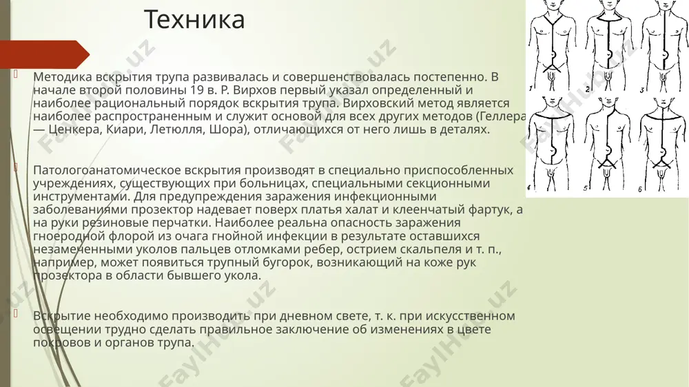 аутопсия - Page 5