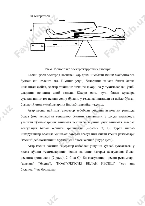мато учун қувват этарли эмаслигини англатади. кесиш электрожарроҳлик асбоблари ечилаётган вазифага қараб ҳар хил шаклларда бўлиши мумкин: пичоқлар, игналар, илгаклар, илмоқлар, "елканлар" ва бошқалар, лекин улар ҳар доим нейтрал электрод майдонига нисбатан мато билан кичик алоқа майдонига эга бўлиши керак. қурилмага ўрнатилган "тоза кесиш" режимида қоида ишлайди: асбоб қанчалик нозик бўлса ва унинг тўқима орқали ҳаракатланиш тезлиги қанчалик тез бўлса, тўқималарнинг термал шикастланиши шунчалик кам бўлади ва электрожарроҳлик кесмаси ўткир скалпел кесмасига ўхшайди. бу, масалан, биопсия олишда ва косметик кесмаларда муҳим аҳамиятга эга. монополяр алоқа коагуляцияси монополяр контактли коагуляция гемостазга эришиш ва патологик тўқималарни девитализация қилиш учун жарроҳликда қўлланилади. юқори частотали оқимнинг оқим даври монополяр кесиш режими учун юқорида тавсифланганларга ўхшайди. контакт монополяр коагуляция учун фаол электрод воситаси (масалан, электрод тўпи) кесиш асбобига (масалан, электрод игнаси) қараганда анча катта майдонга эга. фаол электрод ва беморнинг танаси алоқа қиладиган жойда электр контактининг майдони кичик, оқим юқори зичликка эга ва шунинг учун …