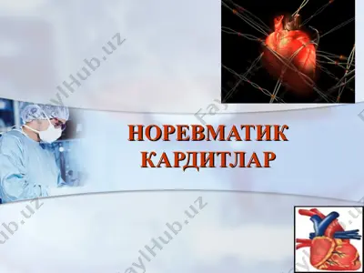 norevmatik karditlar — PPT