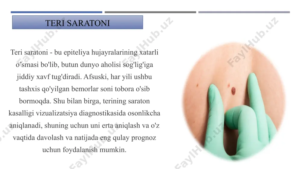 tiq xavf omillari bo'lgan odamlarga muntazam ravishda onkologga tashrif buyurib, keyingi tekshiruvdan o'tish tavsiya etiladi. zamonaviy onkologiyada teri shakllanishini boshqarish uchun "xollar xaritasi" va ularning tasvirini olish, ma'lumotlarni saqlash va keyingi tadqiqotlar natijalari bilan taqqoslash imkonini beruvchi “foto finder” muolajasidan foydalanish tavsiya etiladi. bu yangi paydo bo'lgan yoki mavjud shakllanishdagi o'zgarishlarni eng dastlabki bosqichda aniqlash, o'z vaqtida davolashni amalga oshirish va barqaror uzoq muddatli remissiya ehtimolini yuqori bo'lishiga imkon beradi. teri saratoni belgilari teri saratonining har bir turi o'ziga xos belgilarga ega, ammo ularning har biri quyidagi belgilarga ega: bosim paytida kuchayishi mumkin bo'lgan kasallanish sohasidagi og'riq qichishish qon ketishi va yaralar paydo bo’lishi terining rangsizlanishi og'riq va shishgan limfa tugunlari teri hududining qalinlashishi teri saratoni bosqichlari ko'pgina omillar va ayniqsa bu jarayonning bosqichi va shakli bemorlarning umr ko'rish davomiyligiga ta'sir qiladi. teri saratoni, boshqa neoplazmalar singari, 5 bosqichdan o'tadi: 0-bosqich – bu bosqichda faqat epiteliyning yuqori qatlamlari ta'sirlanadi, besh …