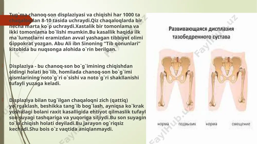 holatda bo`ladi. bir tomon chiqqan bo`lsa, bo`g`im chiqqan oyoq tashqariga burilib turadi. 4.bir tomonlama chiqqanda bir oyoq ikkinchisiga nisbatan kalta bo`ladi. davolash davo muolajalri erta muddatlarda olib borilishi kerak. bunda bolalar oyoqlari ochilgan va bukilgan holda ushlovchi fiksatorlardan foydalaniladi:apparatlar, shinalar, stremenlar, va maxsus yostiqchalar. erta yoshdagi bolalar elastic konstruksiyaga ega bo’lgan moslamardan foydalangan yaxshiroq. masalan, pavlikov stremenasi ko`krak qismga taqish uchun mo`ljallangan moslama, bunda bola oyoqlari tashqariga ochilgan va tizza bo’g’imida bukilgan holatda onasining ko’krak qismida osilgan holatda turadi. og’ir holatlarda oyoqlarni kerakli holatda ushlagan holatda gipsli bog’lam qo’yiladi va bo’g’im immobilizatsiya qilinadi. bu kabi davo 2 yoshdan 6 yoshgacha bo’lgan bolalarda o’tkaziladi, 8 yoshgacha bo’lgan bolalarda son tortmaga olinadi. agar ushbu tadbirlar foyda bermasa jarrohlik amaliyoti amalga oshiriladi. image1.jpg image2.jpg image3.jpg image4.jpg image5.jpg image6.jpg image7.jpg image8.jpg image9.jpg image10.jpg image11.jpg image12.jpg image13.jpg image14.jpg image15.jpg image16.jpg image17.jpg image18.jpg image19.jpg image20.jpg image21.jpg image22.jpg image23.jpg image24.jpg image25.jpg image26.jpg image27.jpg image28.jpg image29.jpg image30.jpg image31.jpg …