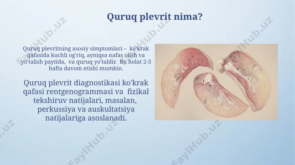 asi talab qilishi mumkin. tashxis qo'yish usullari ko'krak qafasi rentgenografiyasi o'pka absessi va plevritning xarakterli belgilarini, masalan, suyuqlik to'planishini yoki o'pka to'qimasidagi yiringli bo'shliqni aniqlashga yordam beradi; taxminan 80% hollarda aniq diagnostika imkonini beradi. kompyuter tomografiyasi (kt) yuqori aniqlikda o'pka absessi va plevritning hajmini, joylashuvini va murakkabligini, shu jumladan, 5 mm dan kichik bo'lgan o'zgarishlarni ham aniqlash imkonini beradi. davolash usullari (quruq plevrit) ko'krak qafasi rentgenografiyasi va kompyuter tomografiyasi (kt) kabi tasviriy diagnostika usullari quruq plevritni aniqlash va uning og'irligini baholashda muhim rol o'ynaydi. quruq plevritni davolashda yallig'lanishga qarshi steroid bo'lmagan dorilar (nsaid) kabi 1-2 hafta davomida qo'llaniladigan dori vositalari samarali bo'lishi mumkin, ammo jiddiy asoratlarni bartaraf etish uchun shifokor nazorati zarur. differensial diagnostika quruq plevritni diagnostika qilishda plevral og'riqlarning boshqa sabablari, masalan, qovurg'alararo nevralgiya (taxminan 5% hollarda) yoki miozit kabi holatlarni inobatga olish kerak. ekssudativ plevritni differensial diagnostikasi yuqumli endokardit, revmatik isitma va malign neoplazmalar kabi 10 dan ortiq …