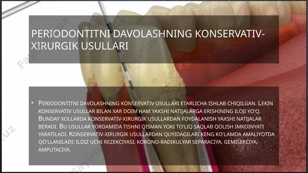 atagiga joylashtiriladi. tishni fiksaciyasi uchun shinalash usullari ham qo'llaniladi. bu usul alveolyar katak atrofiyasini oldini olish va tishni saqlash qolish uchun juda muxim bo'lib xisoblanadi. hech qachon kasal bo’lmang!!! image2.jpeg image3.jpeg image4.jpeg image5.jpeg image6.jpeg image7.jpeg image8.jpeg media1.mp4 image9.png image10.jpeg image11.jpeg image12.jpeg image13.jpeg image14.jpeg image15.jpeg image16.jpeg /docprops/thumbnail.jpeg