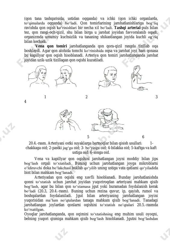 mikrobga qarshi bog‘lash zarur. uncha katta bo‘lmagan jarohatlarga dezinfiksiyalovchi va ifloslanishdan saqlovchi plastir, 5f – 6 kleyi va boshqalar bilan kleylash kerak. agar jarohatlangan joydan qon oqsa birinchi yordam ko‘rsatish usuli qon oqishining ko‘rinishiga bog‘liq bo‘ladi. qon oqishi odatda qon tomirlari butunligi buzilganda har xil intensivlikdagi qon oqishi bilan kuzatiladi. qon oqish: tashqi (qon tana tashqarisida, ustidan oqqanda) va ichki (qon ichki organlarda, to‘qimalarda oqqanda) bo‘ladi. qon tomirlarining jarohatlanishlariga bog‘liq ravishda qon oqish ko‘rinishlari bir necha xil bo‘ladi. tashqi arterial-puls bilan tez, qon rangi-och-qizil, shu bilan birga u jarohat joyidan favvoralanib oqadi, organizmda umumiy kuchsizlik va tananing shikastlangan joyida kuchli og‘riq bilan kechadi. vena qon tomiri jarohatlanganda qon qora-qizil rangda tizillab oqa boshlaydi. agar qon alohida tomchi ko‘rinishida oqsa va jarohat joyi ham qonasa bu kapillyar qon oqish hisoblanadi. arteriya qon tomiri jarohatlanganda jarohat joyidan uzik-uzik tizillagan qon oqishi kuzatiladi. 1 2 3 4 5 6 20.4.-rasm. arteriyani ostki suyaklarga …