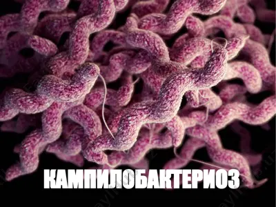 kampilobakterioz — PPT