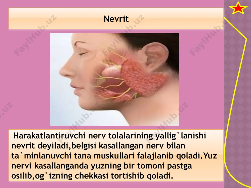 nerv sistemasi kasalliklari - Page 3