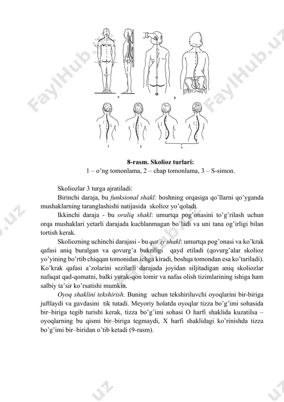 tekis (yalpoq) va yassi oyoq bo’ladi (10-rasm). oyoqning ostki sohasini kо’rikdan о’tkazganda tayanch yuzasiga, oyoq tovoni bilan oyoq ostki oldingi sohasi birikish qismi qanchalik kengayligiga e’tibor beriladi. bundan tashqari, axill pay bog’lamlarining vertikal yо’nalishdagi о’qi va yuklama tushgan holatda oyoq tovonlari sohalarining о’zgarishlari tekshiriladi. 10-rasm. oyoq kaftining tashqi kо’rinishi: а - meyoriy holatda; b - tekis; c - yassi oyoqlikning turli darajalari. shtritter metodi boʼyicha yassioyoqlikni aniqlash. kо’rikdan о’tkazganda oyoq tag sohasining izi olinadi (plantografiya). oyoq ostki sohasiga vazelin yoki biror-bir bо’yoq surtib, sо’ngra oq qog’ozga qо’yiladi, so’ng oyoq izlariga qarab yassioyoqlik holati bor-yо’qligini ham bilish mumkin. buning uchun: · oyoq izining ichki qismidagi eng chiqib turgan nuqtalarga urinma chiziq (аb) tortiladi. · аb kesmaning oʼrtasi topiladi (c). · аb kesmaning oʼrtasidan izning tashqi chekkasi bilan kesishgan joyigacha perpendikulyar (ce) oʼtkaziladi. · d nuqta – oyoq kafti izining ichki tomoni bilan perpendikulyarni kesishgan joyi va e – nuqta, perpendikulyarning izning …